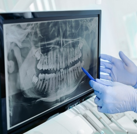 Dentist pointing to a computer screen showing x rays of teeth