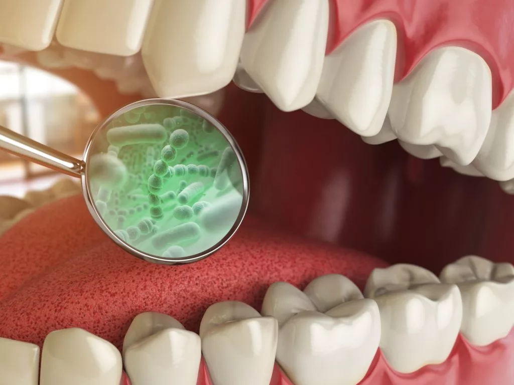 Bad Breath & Halitosis treatments at First Impressions Dentistry in Oklahoma City, OK