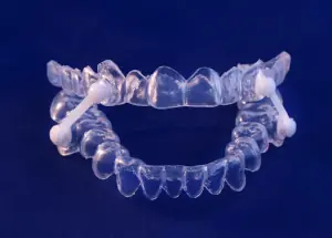 Custom Sleep Apnea Mouthguards are now available at First Impressions Dentistry in Oklahoma City, OK